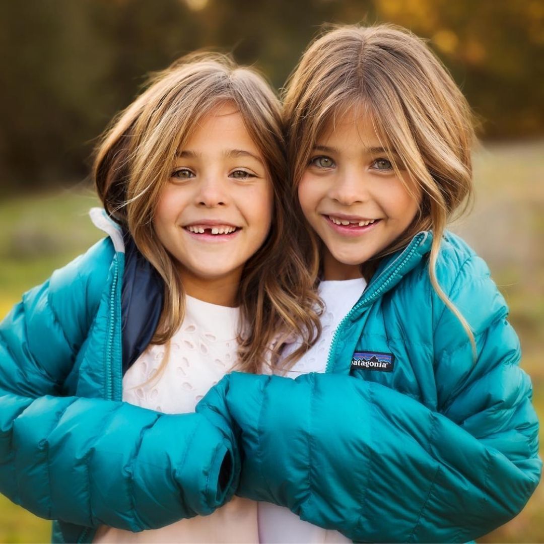 Most Beautiful Twins in the World. Then & Now!